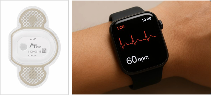 ホルター心電図、スマートウォッチ